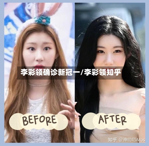 李彩领确诊新冠一/李彩领知乎
