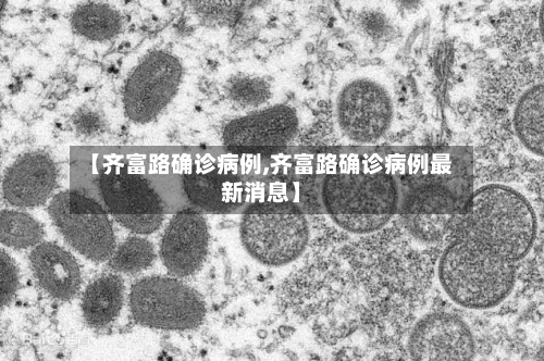 【齐富路确诊病例,齐富路确诊病例最新消息】-第2张图片