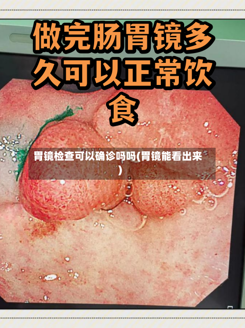 胃镜检查可以确诊吗吗(胃镜能看出来)