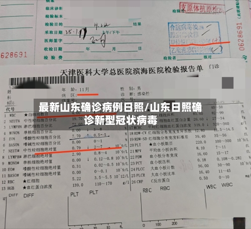 最新山东确诊病例日照/山东日照确诊新型冠状病毒-第2张图片