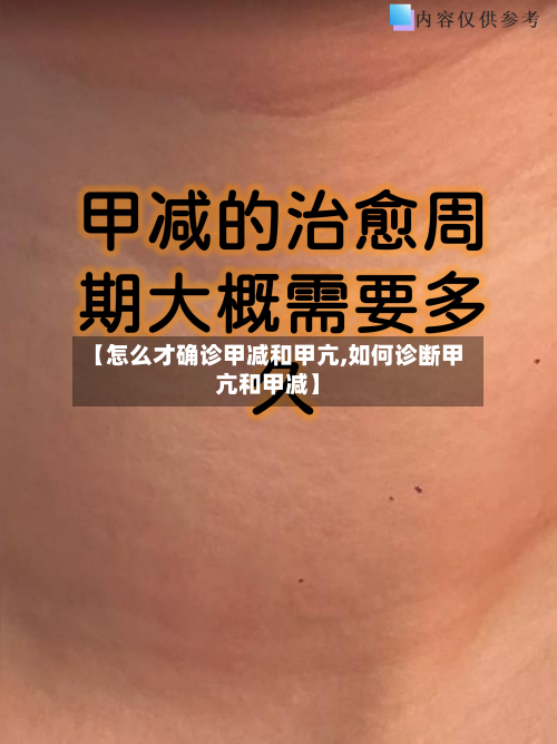 【怎么才确诊甲减和甲亢,如何诊断甲亢和甲减】-第3张图片