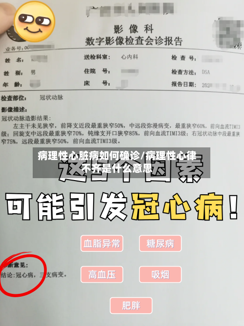 病理性心脏病如何确诊/病理性心律不齐是什么意思-第2张图片