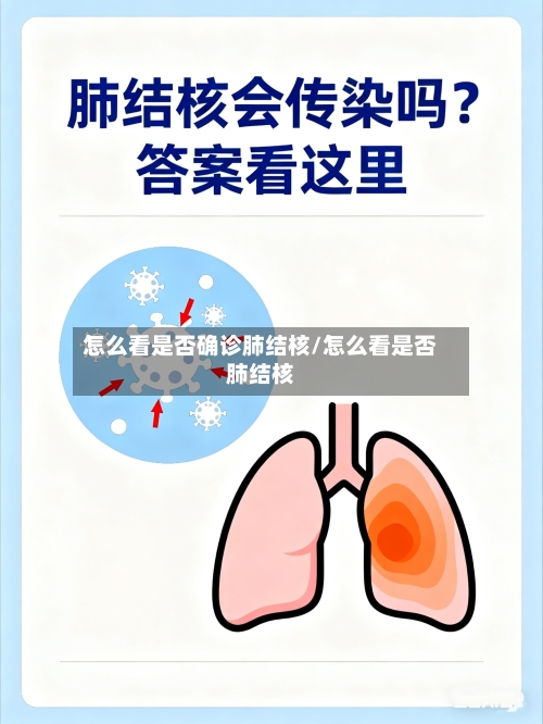 怎么看是否确诊肺结核/怎么看是否肺结核-第2张图片
