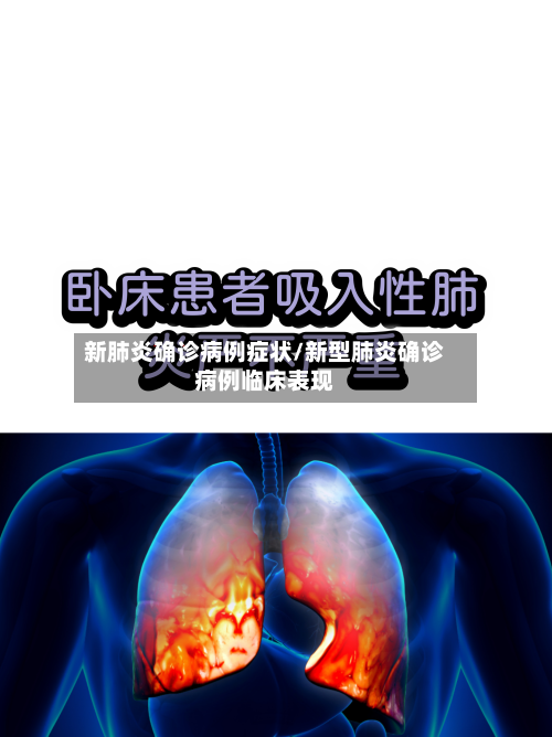 新肺炎确诊病例症状/新型肺炎确诊病例临床表现-第3张图片