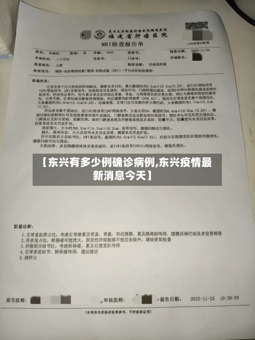 【东兴有多少例确诊病例,东兴疫情最新消息今天】-第3张图片