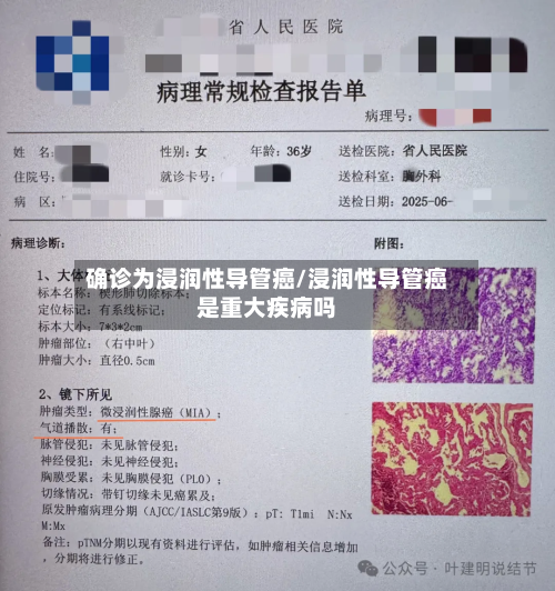 确诊为浸润性导管癌/浸润性导管癌是重大疾病吗-第2张图片