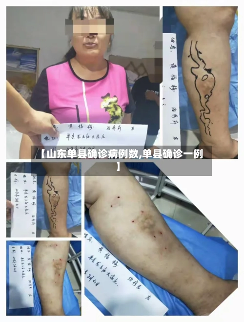 【山东单县确诊病例数,单县确诊一例】-第2张图片