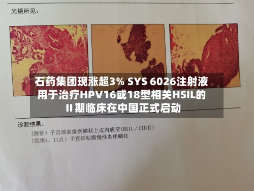 石药集团现涨超3% SYS 6026注射液用于治疗HPV16或18型相关HSIL的Ⅱ期临床在中国正式启动-第2张图片