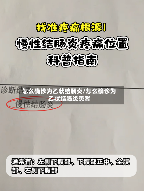 怎么确诊为乙状结肠炎/怎么确诊为乙状结肠炎患者-第2张图片