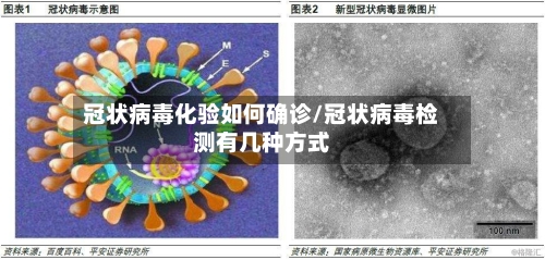 冠状病毒化验如何确诊/冠状病毒检测有几种方式-第2张图片