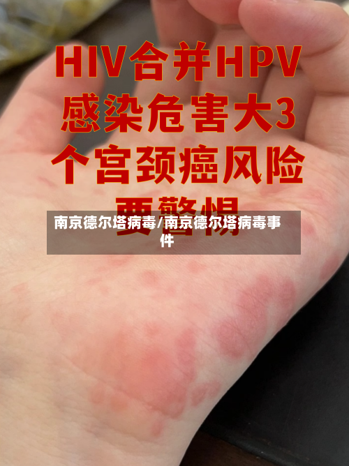 南京德尔塔病毒/南京德尔塔病毒事件