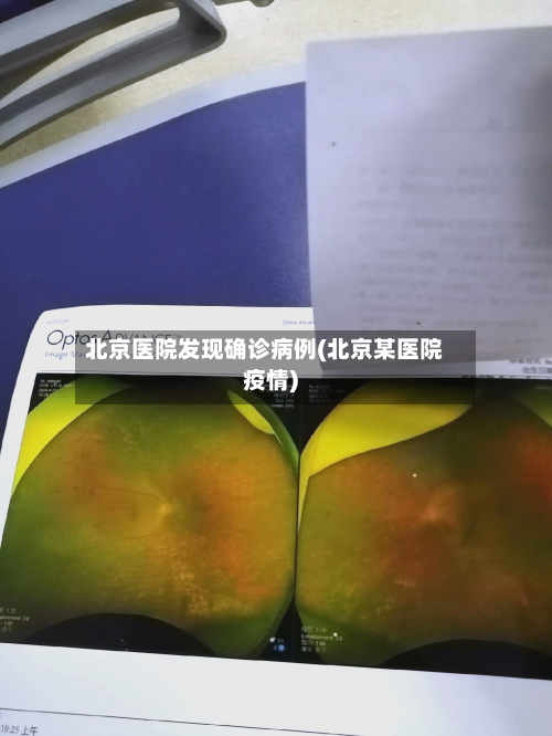 北京医院发现确诊病例(北京某医院疫情)